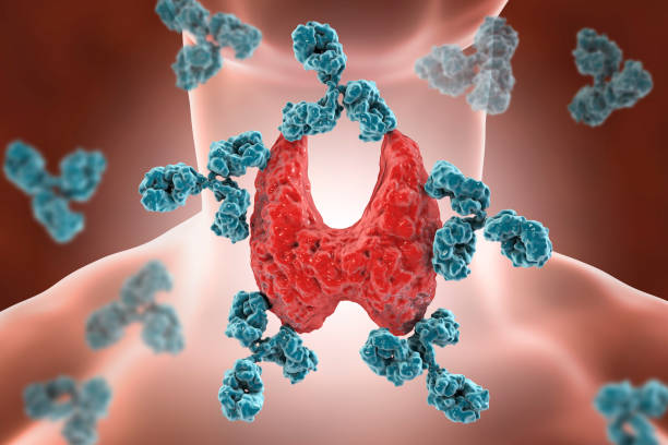 Malattie autoimmuni e infiammazione